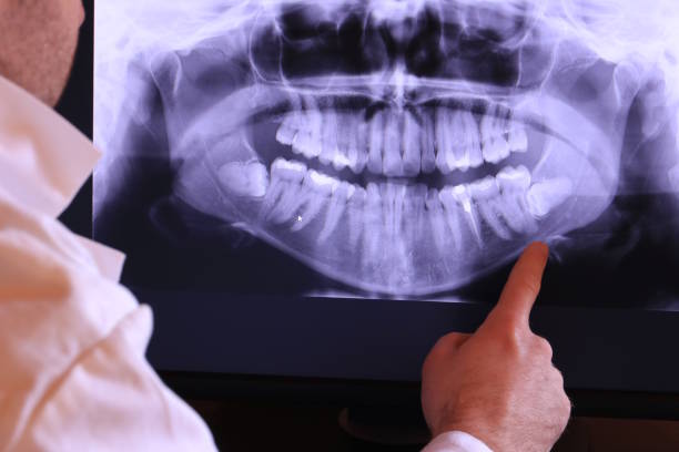 Best Tooth Infection Emergency Dentist  in Apache, OK