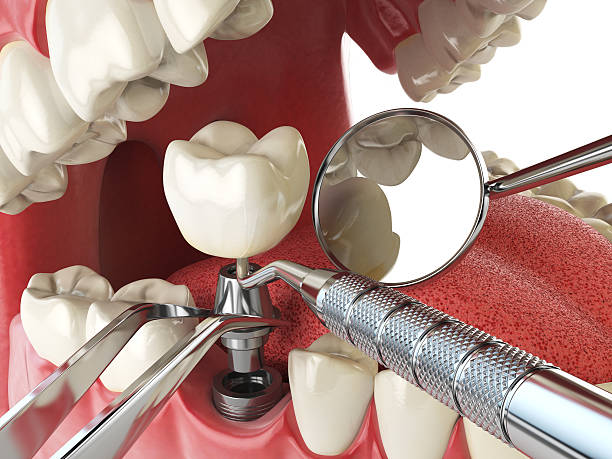 , OK Emergency Dentist Company